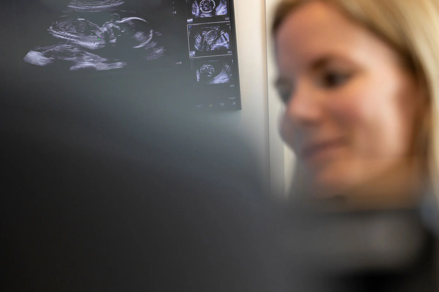Gynekologian erikoislääkärin vastaanotto ja raskausajan ultraäänitutkimus